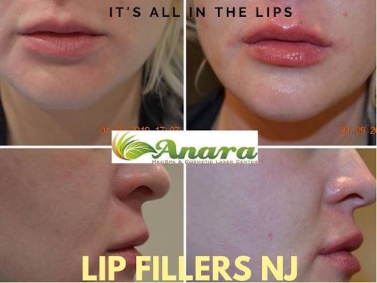 Anara MedSpa and Cosmetic Laser Center