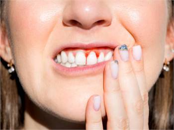 Various types of gum disease treatment for you